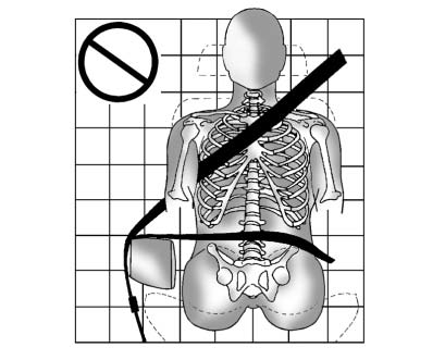 A: The belt is over an armrest.