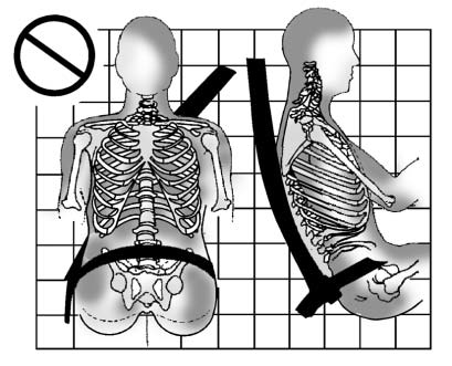 A: The belt is behind the body.