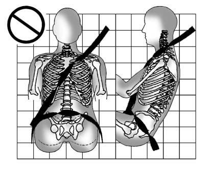 A: The belt is twisted across the body.