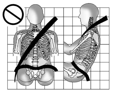 A: The lap belt is too loose. It will not give nearly as much protection this way.