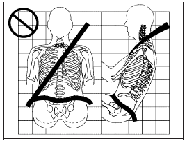 A: The lap belt is too loose. It will not give nearly