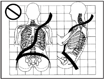 A: The shoulder belt is too loose. It will not give as