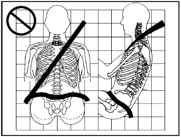 A: The lap belt is too loose. It will not give nearly as