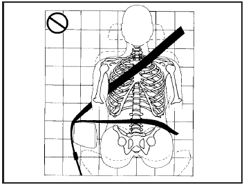 A: The belt is over an armrest.