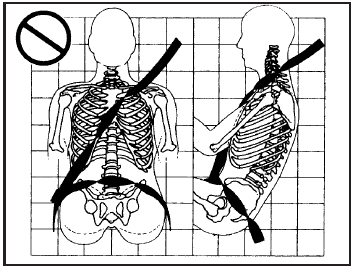 A: The belt is twisted across the body.