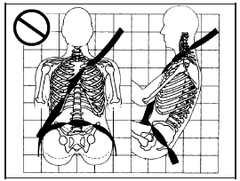 A: The belt is twisted across the body.